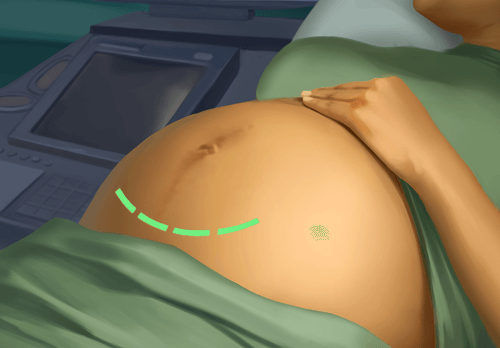 Operate Now Hospital – Surgery